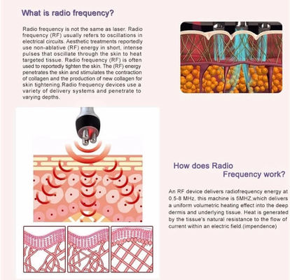 Beauty Salon Remove Wrinkles Mini RF Skin Beauty Device